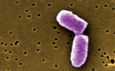 E. coli paso robles